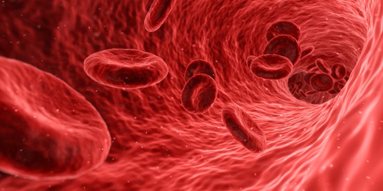 Nuevos stents venosos para prevenir el síndrome postrombótico