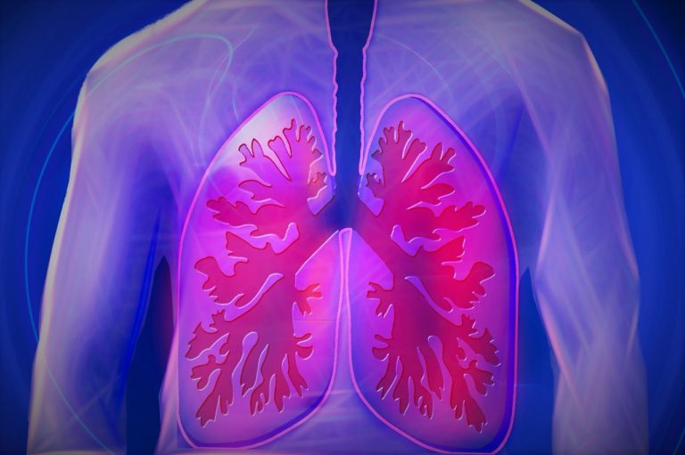 La Jiménez Díaz pone en marcha un protocolo para el tromboembolismo pulmonar